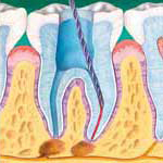 Root canal during photo