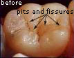 Dental photos