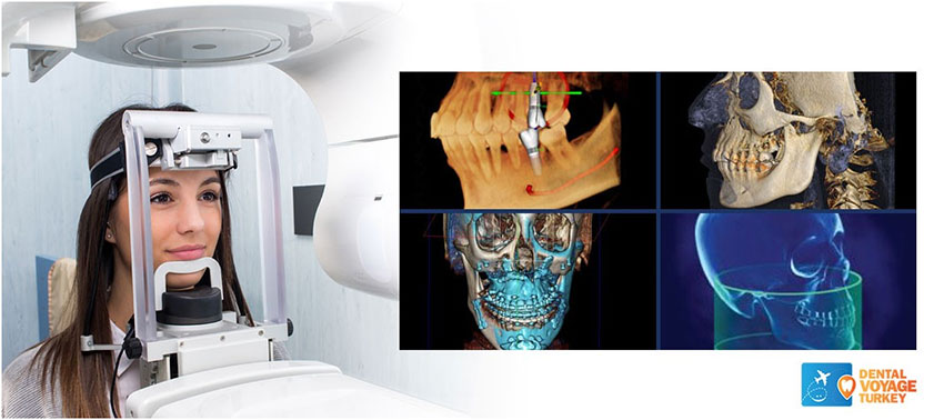 New technology of CT Scans