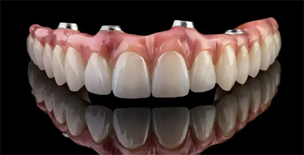 fixed-implant dentures