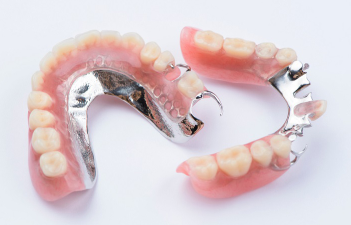 partial dentures
