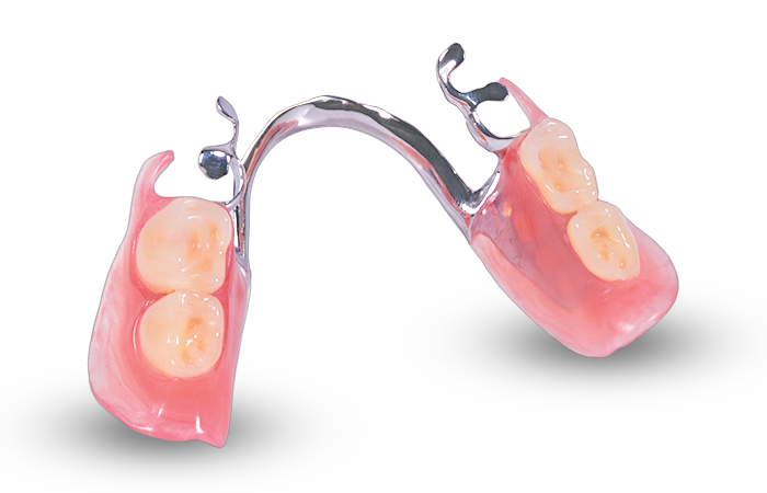 partial dentures